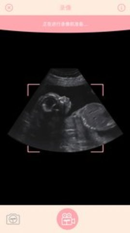 Fetus Camera（胎儿相机）