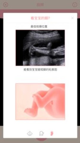 Fetus Camera（胎儿相机）